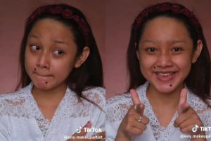 Transformasi makeup wanita dengan wajah belang ini sampai dikira beda orang, matanya cetar abis