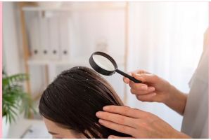 12 Arti mimpi banyak kutu di kepala yang menyeramkan menurut Islam, isyarat kehidupan akan terganggu