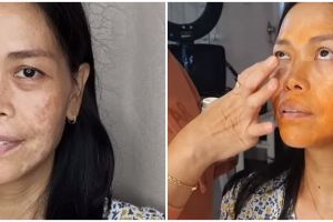 Transformasi makeup wanita dengan wajah penuh flek hitam ini hasilnya flawless dan bak beda orang