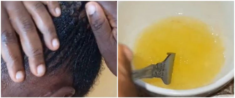 Tanpa tambahan lemon, cara wanita hempas ketombe dan gatal di kepala ini cuma pakai 2 bahan dapur