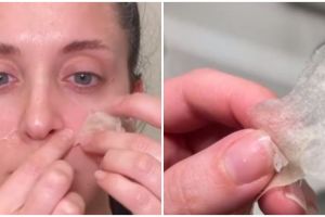 Tak perlu beli nose strip, ini cara atasi komedo membandel di area hidung hanya pakai 1 bahan dapur