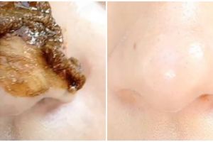 Bantu hempas komedo, cara wanita bersihkan pori-pori di hidung ini cuma pakai 4 bahan dapur