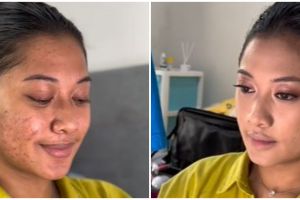 Transformasi makeup wanita wajah penuh bekas jerawat dan bertekstur ini hasilnya mulus tanpa dempul