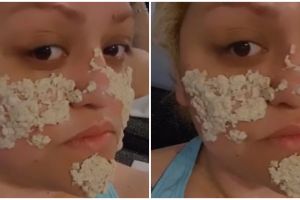 Tanpa serum khusus, trik rapatkan pori-pori besar akibat komedo ala TikToker ini pakai 1 jenis buah