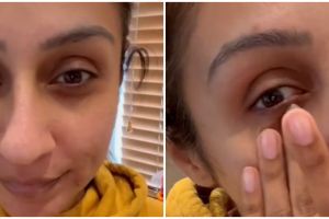 Tanpa produk khusus, cara atasi kantung mata hitam ala wanita paruh baya ini cuma pakai 1 jenis umbi