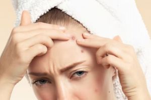 11 Rekomendasi skincare untuk jerawat nanah merek lokal di bawah Rp 150 ribu, bikin cepat kering