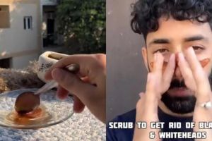 Tanpa toner eksfoliasi, intip trik pria ini bikin wajah bersih dari komedo pakai 2 bahan dapur