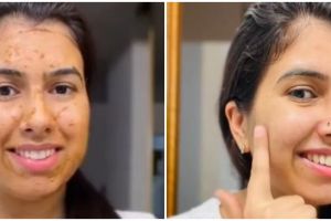 Tanpa oatmeal, trik rapatkan pori-pori besar di wajah ala wanita India ini cuma pakai 2 bahan dapur