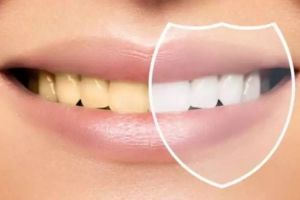 Bukan pakai garam, begini trik memutihkan gigi kuning dan berkerak pakai 1 jenis buah