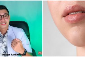 Tanpa beli lip balm, dokter ini bagikan trik ampuh bikin bibir merah alami hanya pakai 1 jenis tanaman