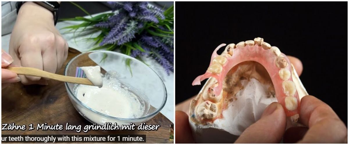Tanpa dicampur baking soda, trik beauty vlogger mencerahkan gigi
