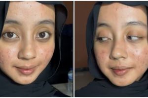 Transformasi makeup wanita dengan wajah breakout hasilnya flawless, riasan matanya bak barbie