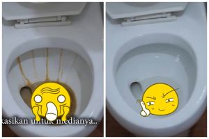Tanpa diamplas, ini cara cepat bersihkan kerak membandel di kloset cukup andalkan 2 bahan dapur