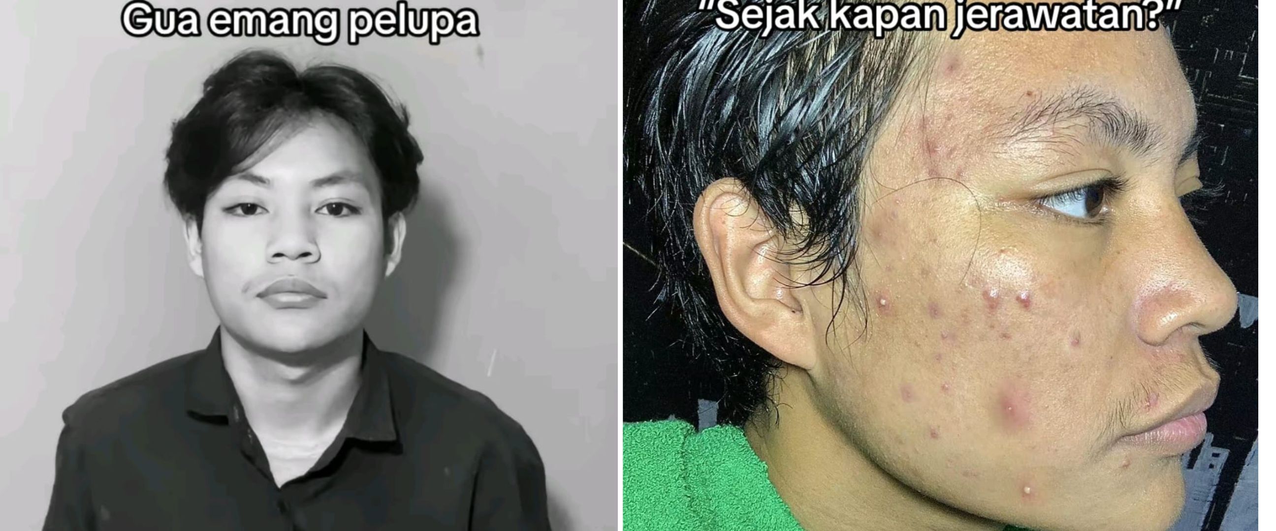 Cerita karyawan nggak diizinin tangani pelanggan karena wajah berjerawat ini nyesek banget