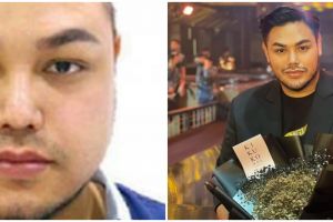 Potret 21 seleb sebelum dan sesudah lakukan filler di wajah ini manglingi