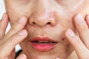 11 Rekomendasi base makeup untuk kulit berminyak harga di bawah Rp 200 ribu, auto bebas kilap