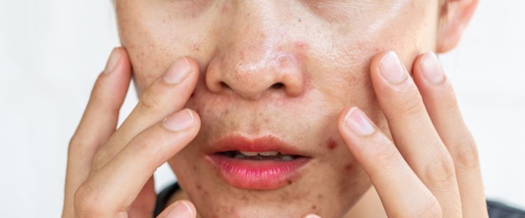 11 Rekomendasi base makeup untuk kulit berminyak harga di bawah Rp 200 ribu, auto bebas kilap