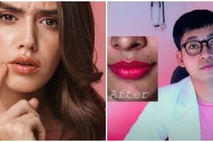 Tanpa treatment mahal, trik mencerahkan bibir hitam menurut dokter ini cuma pakai 1 produk pembersih