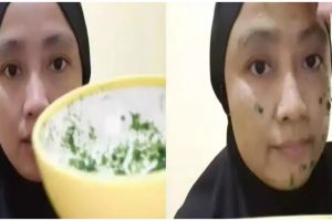 Tanpa treatment laser, ini 12 cara menghilangkan bekas jerawat di wajah pakai campuran bahan alami
