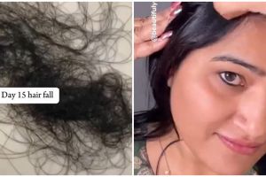 Hasil terlihat dalam sebulan, wanita ini tunjukkan cara tumbuhkan rambut rontok pakai 1 bahan makanan