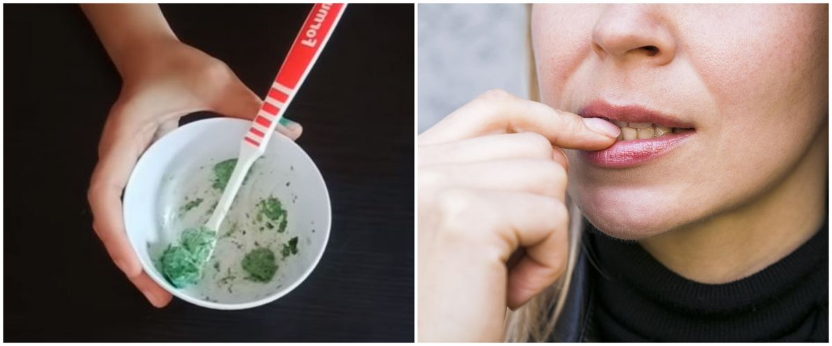 Tanpa dicampur baking soda, emakemak ini putihkan gigi kuning pa