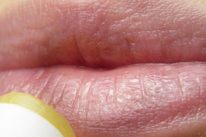 10 Cara efektif untuk mengatasi bibir yang gelap, auto jadi cerah lagi