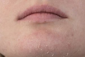 10 Rekomendosi basic skincare untuk kulit kering harga di bawah Rp 150 ribu, wajah terhidrasi