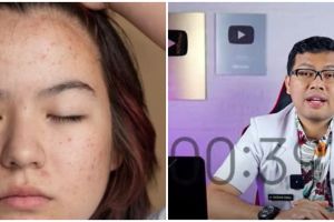 Tanpa laser mahal, cara atasi beruntusan di wajah menurut dokter ini cuma butuh 1 jenis tanaman herbal
