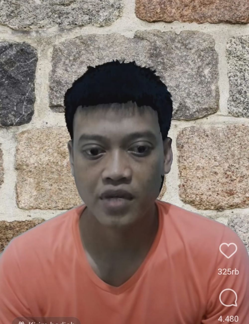 Mengenal Papiledema, penyakit serius yang diderita Kurnia Meiga hingga kehilangan karier mentereng