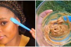 Tanpa laser, cara atasi flek hitam pakai kunyit dicampur 2 bahan alami ini bikin wajah cerah merata