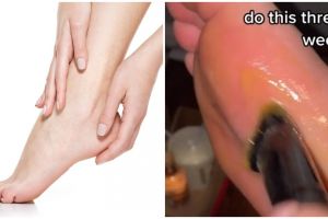 Bikin lembut dan antikasar, cara atasi kaki kering ini cuma pakai 1 jenis bahan pemanis