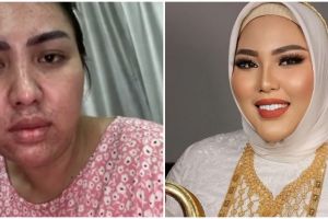 Gayanya emak-emak sosialita padahal masih 28 tahun, 9 potret dulu dan kini bos skincare Mira Hayati