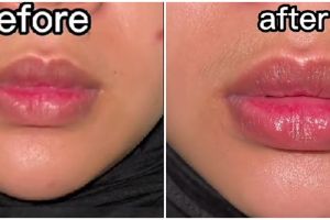 Tak cuma madu, wanita ini bagikan cara atasi bibir kering dan gelap dengan tambahan 1 bahan alami
