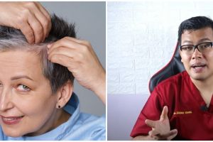 Tanpa tambahan henna, cara mengurangi tumbuhnya uban menurut dokter ini cuma pakai 1 sampah dapur