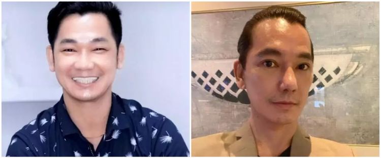 9 Potret seleb pria sebelum dan sesudah operasi plastik, penampilan Eddy Siswanto bak beda orang
