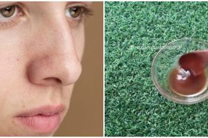 Bukan pakai oatmeal, ini trik pudarkan pori-pori besar cuma gunakan 2 bahan alami