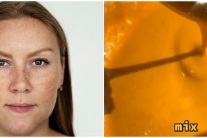 Tak cuma pakai kunyit, ini cara pudarkan flek hitam di pipi dengan tambahan 2 bahan dapur