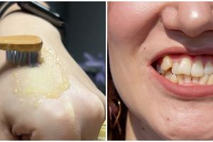 Putih dalam satu menit, ini cara atasi gigi kuning pakai baking soda dicampur 1 jenis buah