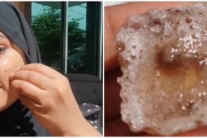 Bukan pakai kunyit, trik atasi flek hitam agar wajah cerah merata ini cuma dengan 1 jenis umbi-umbian