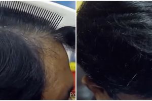 Tanpa ditutup semir, ini cara mengatasi uban pakai bunga sepatu dicampur 2 bahan alami