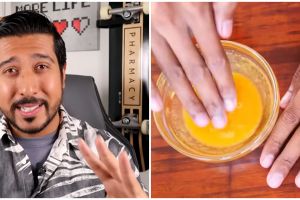 Tanpa gunakan body lotion, dokter ini tunjukkan cara haluskan tangan kasar pakai 1 jenis protein