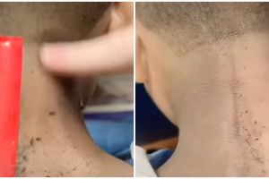 Tanpa produk eksfoliasi, konten kreator ini tunjukkan cara atasi leher hitam pakai 1 bahan dapur