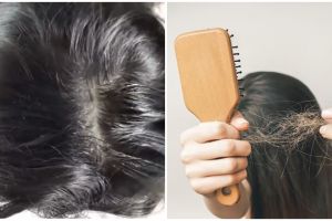 Tanpa bawang merah, beauty vlogger ini perlihatkan cara tumbuhkan rambut rontok pakai 1 bahan makanan