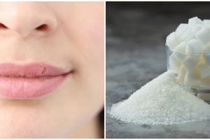 Bikin lembap kembali, ini 11 cara mengatasi bibir kering pecah-pecah pakai bahan dapur
