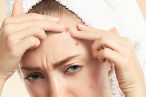 10 Rekomendasi skincare Scarlett untuk mengatasi jerawat harga di bawah Rp 100 ribu, kulit auto mulus