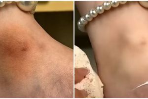 Tanpa jus kentang, beauty vlogger ini tunjukkan cara cerahkan mata kaki hitam pakai 1 jenis tepung