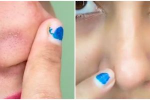 Tanpa facial, trik atasi komedo di hidung pakai pasta gigi dicampur 1 jenis buah ini bikin wajah halus