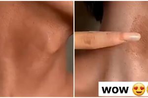 Tak perlu krim pemutih, cara atasi leher hitam pakai madu dicampur 3 bahan alami ini bikin auto cerah