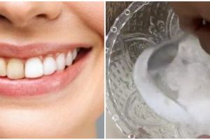 Tak cuma garam, ini cara atasi gigi kuning berkarang agar kembali putih pakai tambahan 2 bahan dapur