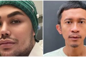 Bikin penampilan lebih macho, ini potret 7 seleb pria sebelum dan sesudah lakukan treatment sulam alis